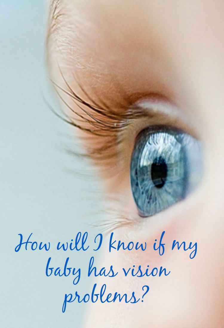 How will I know if my baby has vision problems?